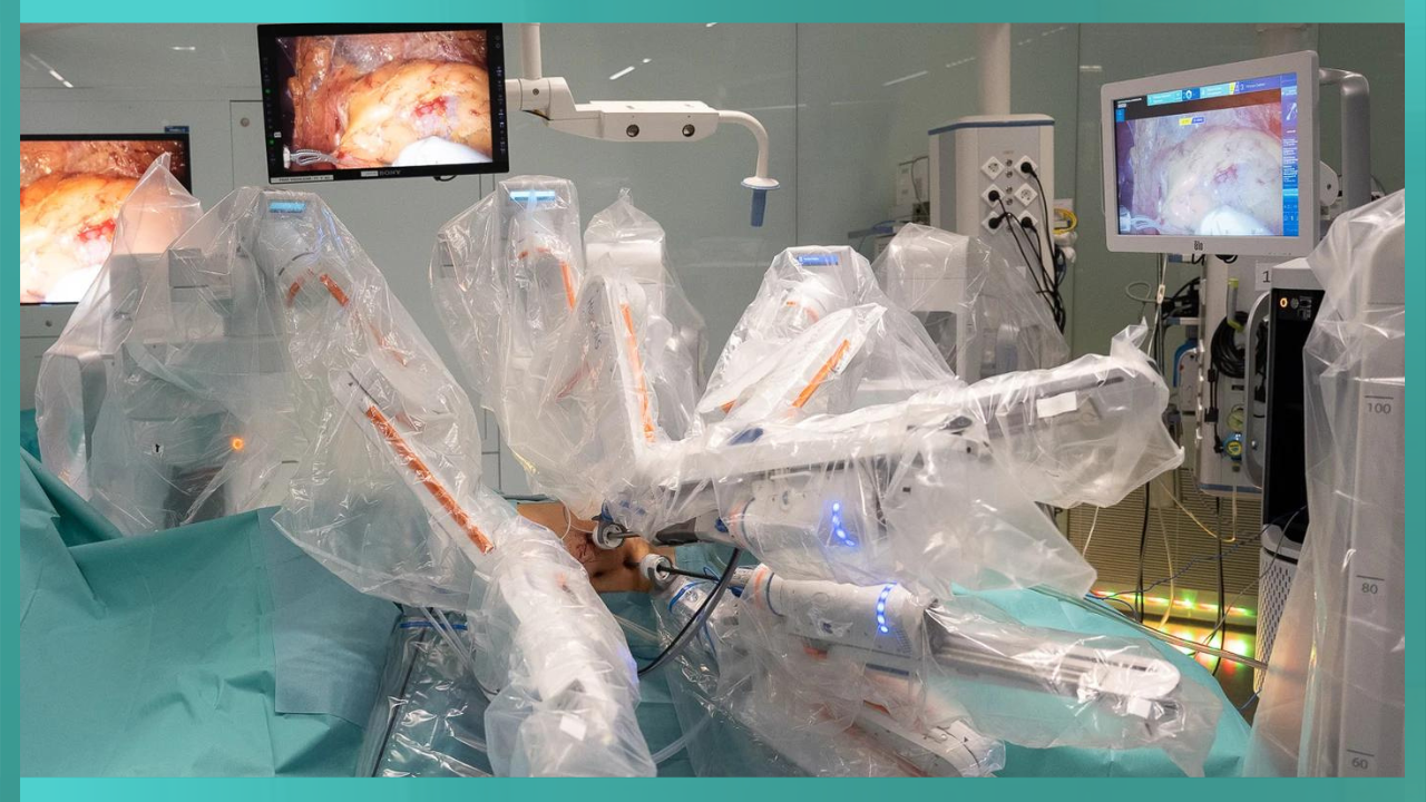 Robot da Vinci durante una prostatectomia radical en un paciente con cáncer de próstata