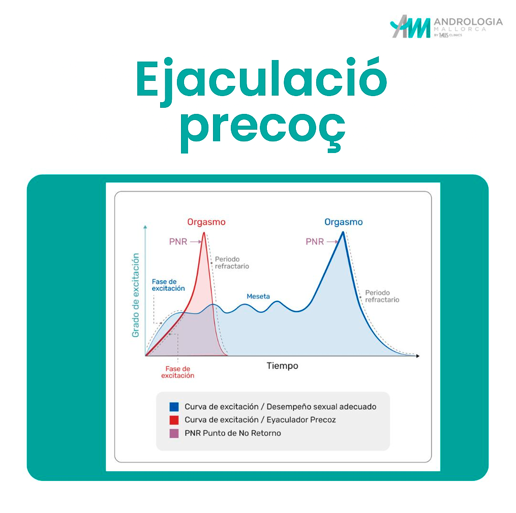 ejaculació precoç